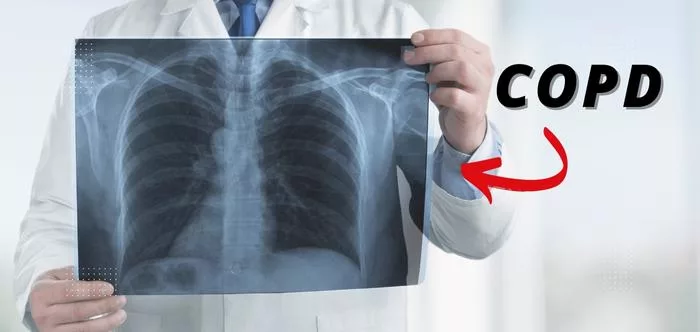 What Is Copd